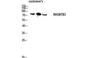 Western Blot (WB) analysis of lysis using RHOBTB3 antibody. (RHOBTB3 anticorps  (Internal Region))