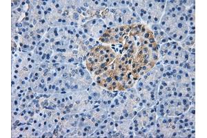 Immunohistochemical staining of paraffin-embedded liver tissue using anti-AKR1A1mouse monoclonal antibody. (AKR1A1 anticorps)