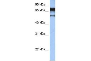 ZNF780B antibody used at 0. (ZNF780B anticorps  (N-Term))