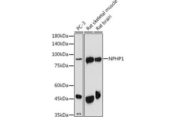 NPHP1 anticorps  (AA 345-614)