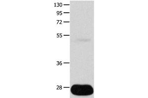 Western Blot analysis of Human liver cancer tissue using POMC Polyclonal Antibody at dilution of 1:450 (POMC anticorps)