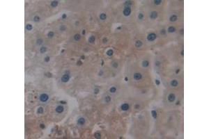 IHC-P analysis of Human Tissue, with DAB staining. (SPP2 anticorps  (AA 30-211))