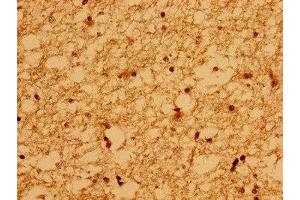 Immunohistochemistry of paraffin-embedded human brain tissue using ABIN7175718 at dilution of 1:100 (WDPCP anticorps  (AA 621-737))