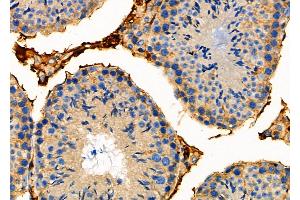 ABIN6259349 and ABIN6275564 at 1/100 staining Mouse testis tissue by IHC-P. (STAC2 anticorps  (Internal Region))