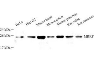 Western blot analysis of MRRF (ABIN7074657) at dilution of 1: 1000 (MRRF anticorps)