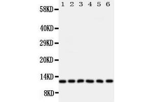 Anti-Glutaredoxin 2 antibody, Western blotting Lane 1: Rat Testis Tissue Lysate Lane 2: HELA Cell Lysate Lane 3: U87 Cell Lysate Lane 4: NEU Cell Lysate Lane 5: JURKAT Cell Lysate Lane 6: MCF-7 Cell Lysate (Glutaredoxin 2 anticorps  (Middle Region))
