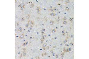 Immunohistochemistry of paraffin-embedded rat brain using ISG15 Antibody.