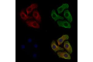 ABIN6255780 and ABIN6267335 staining Hela cells(4h of LPS treatment) by IF/ICC. (IGF1R anticorps  (pTyr1165, pTyr1166))