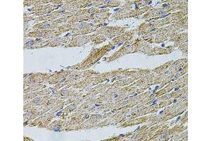 Immunohistochemistry of paraffin-embedded Rat heart using TRPA1 Polyclonal Antibody at dilution of 1:100 (40x lens).
