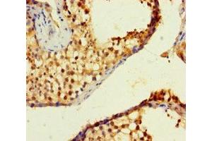 Immunohistochemistry of paraffin-embedded human testis tissue using ABIN7176535 at dilution of 1:100 (ZNF8 anticorps  (AA 1-300))