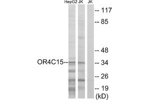 Western blot analysis of extracts from HepG2 cells and Jurkat cells, using OR4C15 antibody. (OR4C15 anticorps  (C-Term))