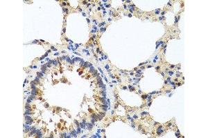 Immunohistochemistry of paraffin-embedded Rat lung using LRG1 Polyclonal Antibody at dilution of 1:100 (40x lens). (LRG1 anticorps)