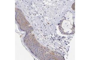 Immunohistochemical staining of human skin with PPFIBP1 polyclonal antibody  shows moderate cytoplasmic positivity in epidermal cells and adnexal cells at 1:200-1:500 dilution. (PPFIBP1 anticorps)