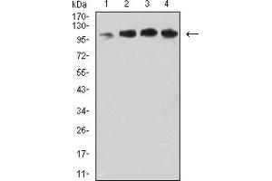Western blot analysis using CD106 mouse mAb against COS7 (1), MCF-7 (2), HepG2 (3), and Hela (4) cell lysate. (VCAM1 anticorps  (AA 25-183))