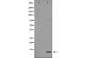 Western blot analysis of lovo cell lysate, using S100A11 Antibody.