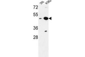Western Blotting (WB) image for anti-Nucleoporin Like 2 (NUPL2) antibody (ABIN3004233) (NUPL2 anticorps)