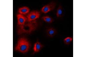 Immunofluorescent analysis of BCLW staining in HL60 cells. (BCL2L2 anticorps  (C-Term))