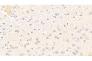 Detection of KEL in Mouse Cerebrum Tissue using Polyclonal Antibody to Kell Protein (KEL)