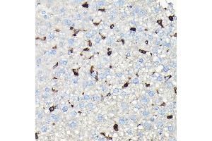 Immunohistochemistry of paraffin-embedded mouse liver using CORO1A Rabbit pAb (ABIN6133495, ABIN6138903, ABIN6138904 and ABIN6224969) at dilution of 1:100 (40x lens).