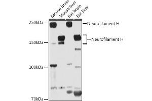 Western blot analysis of extracts of various cell lines, using Neurofilament H antibody (ABIN6129638, ABIN6144512, ABIN6144513 and ABIN6224502) at 1:1000 dilution. (NEFH anticorps  (AA 821-1020))