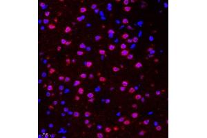Immunofluorescence of paraffin embedded mouse brain using HES3 (ABIN7074159) at dilution of 1:2000 (400x lens) (HES3 anticorps)