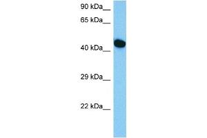 Host:  Mouse  Target Name:  HNF1B  Sample Tissue:  Mouse Skeletal Muscle  Antibody Dilution:  1ug/ml (HNF1B anticorps  (C-Term))