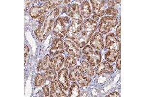 Immunohistochemical staining of human kidney with MFSD7 polyclonal antibody  shows strong cytoplasmic positivity in tubular cells at 1:50-1:200 dilution.