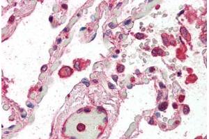 Human Lung (formalin-fixed, paraffin-embedded) stained with CENTB2 antibody ABIN337012 at 5 ug/ml followed by biotinylated anti-goat IgG secondary antibody ABIN481715, alkaline phosphatase-streptavidin and chromogen. (Centaurin beta 2 anticorps  (AA 766-778))