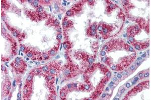 Human Kidney (formalin-fixed, paraffin-embedded) stained with HOXA5 antibody ABIN462218 followed by biotinylated goat anti-rabbit IgG secondary antibody ABIN481713, alkaline phosphatase-streptavidin and chromogen.