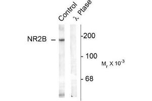 Image no. 1 for anti-Glutamate Receptor, Ionotropic, N-Methyl D-Aspartate 2B (GRIN2B) (pTyr1336) antibody (ABIN372686) (GRIN2B anticorps  (pTyr1336))