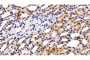 Detection of Kim1 in Rat Kidney Tissue using Polyclonal Antibody to Kidney Injury Molecule 1 (Kim1)