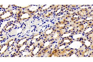 Detection of Kim1 in Rat Kidney Tissue using Polyclonal Antibody to Kidney Injury Molecule 1 (Kim1) (HAVCR1 anticorps  (AA 22-235))