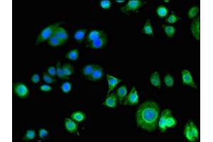 Immunofluorescent analysis of PC-3 cells using ABIN7163671 at dilution of 1:100 and Alexa Fluor 488-congugated AffiniPure Goat Anti-Rabbit IgG(H+L) (PHLDA3 anticorps  (AA 43-95))