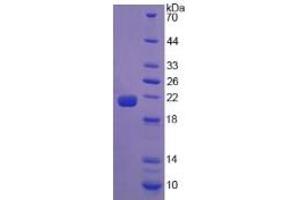 SDS-PAGE of Protein Standard from the Kit (Highly purified E. (Calreticulin Kit ELISA)