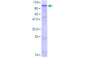 Image no. 1 for Dipeptidyl-Peptidase 4 (DPP4) (AA 1-766) protein (GST tag) (ABIN1351956)