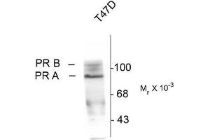 Western Blotting (WB) image for anti-Progesterone Receptor (PGR) (pSer190) antibody (ABIN371834) (Progesterone Receptor anticorps  (pSer190))