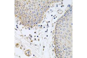 Immunohistochemistry of paraffin-embedded human esophagus using GP2 antibody (ABIN5975023) at dilution of 1/100 (40x lens). (GP2 anticorps)