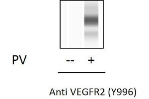 HUVEC cells were untreated or treated with PV. (VEGFR2/CD309 Kit ELISA)