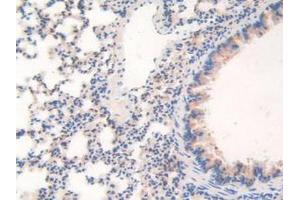 IHC-P analysis of Mouse Lung Tissue, with DAB staining. (WARS anticorps  (AA 29-195))