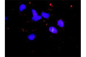 Proximity Ligation Analysis of protein-protein interactions between STK11 and CAB39.