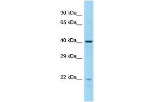 Host:  Rabbit  Target Name:  EME2  Sample Type:  MCF7 Whole cell lysates  Antibody Dilution:  1.