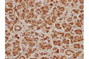 IHC image of ABIN7155415 diluted at 1:100 and staining in paraffin-embedded human pancreatic tissue performed on a Leica BondTM system.
