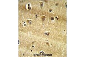 Immunohistochemistry (IHC) image for anti-Ribosomal Protein S9 (RPS9) antibody (ABIN3002715)