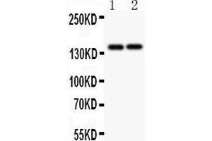 Anti-Collagen III Picoband antibody,  All lanes: Anti Collagen III at 0. (COL3A1 anticorps  (C-Term))