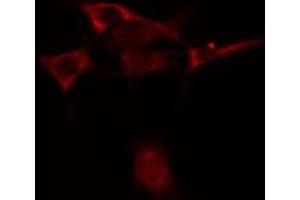 ABIN6275862 staining Hela cells by IF/ICC. (LRP8 anticorps  (Internal Region))