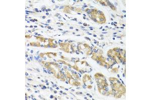Immunohistochemistry of paraffin-embedded human stomach using IL11 antibody (ABIN5975342) at dilution of 1/100 (40x lens). (IL-11 anticorps)