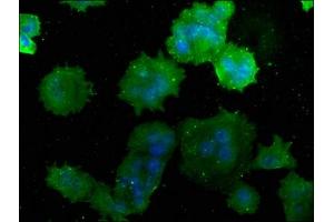 Immunofluorescence staining of MCF-7 cells with ABIN7175232 at 1:50, counter-stained with DAPI.