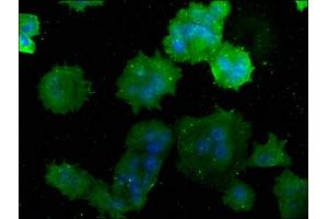 Immunofluorescence staining of MCF-7 cells with ABIN7175232 at 1:50, counter-stained with DAPI. (ATP6V1C1 anticorps  (AA 129-382))