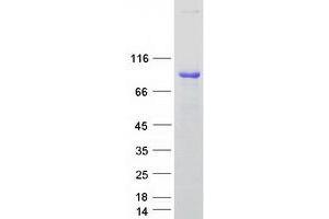 Validation with Western Blot
