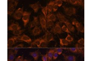Immunofluorescence analysis of C6 cells using SEC23B Polyclonal Antibody at dilution of 1:100. (Sec23 Homolog B anticorps)